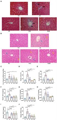 Protective effects of yeast extract against alcohol-induced liver injury in rats